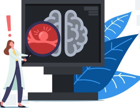 brain aneurysm