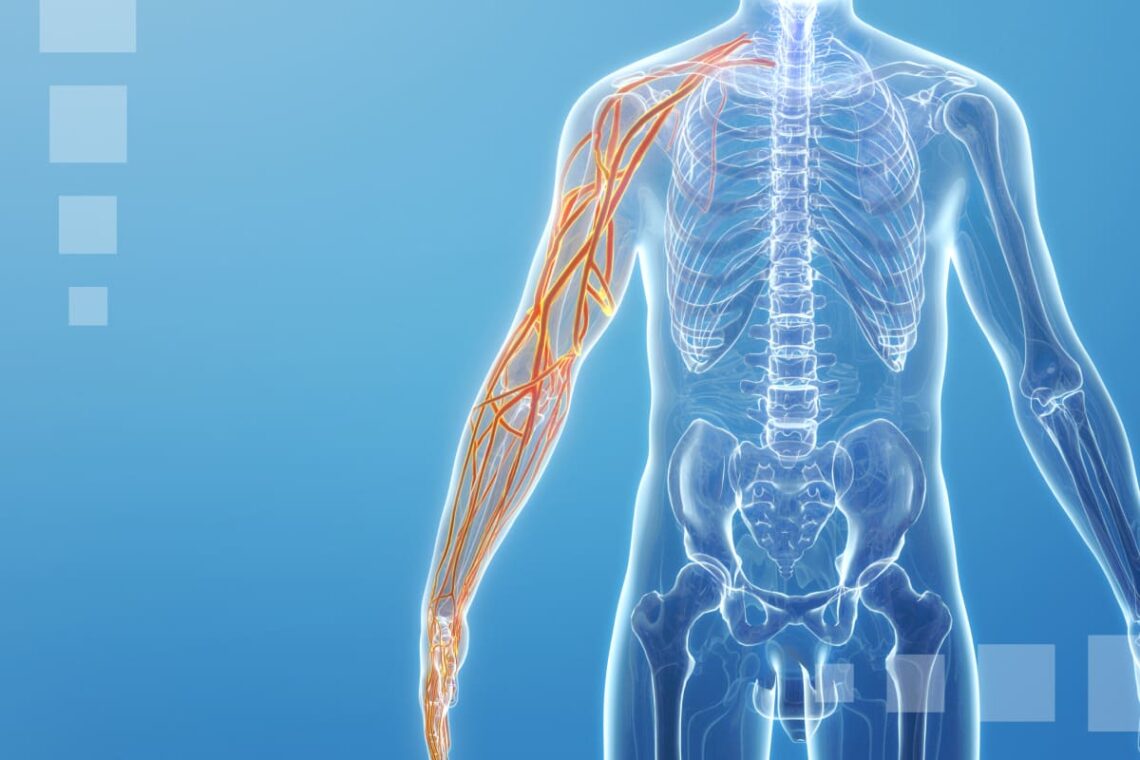 upper limb neuropathy