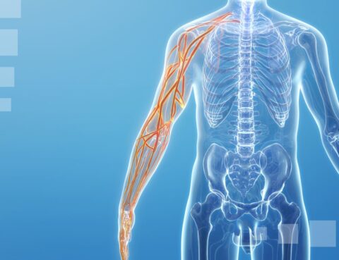 upper limb neuropathy