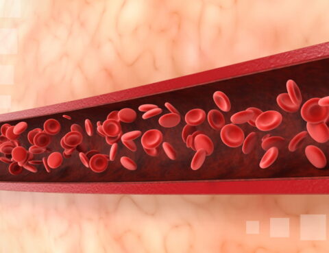 blood vessel disorders