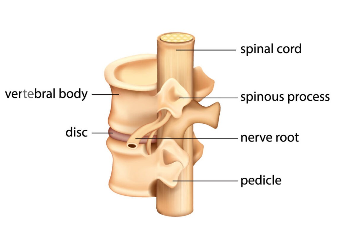 carpal tunnel syndrome