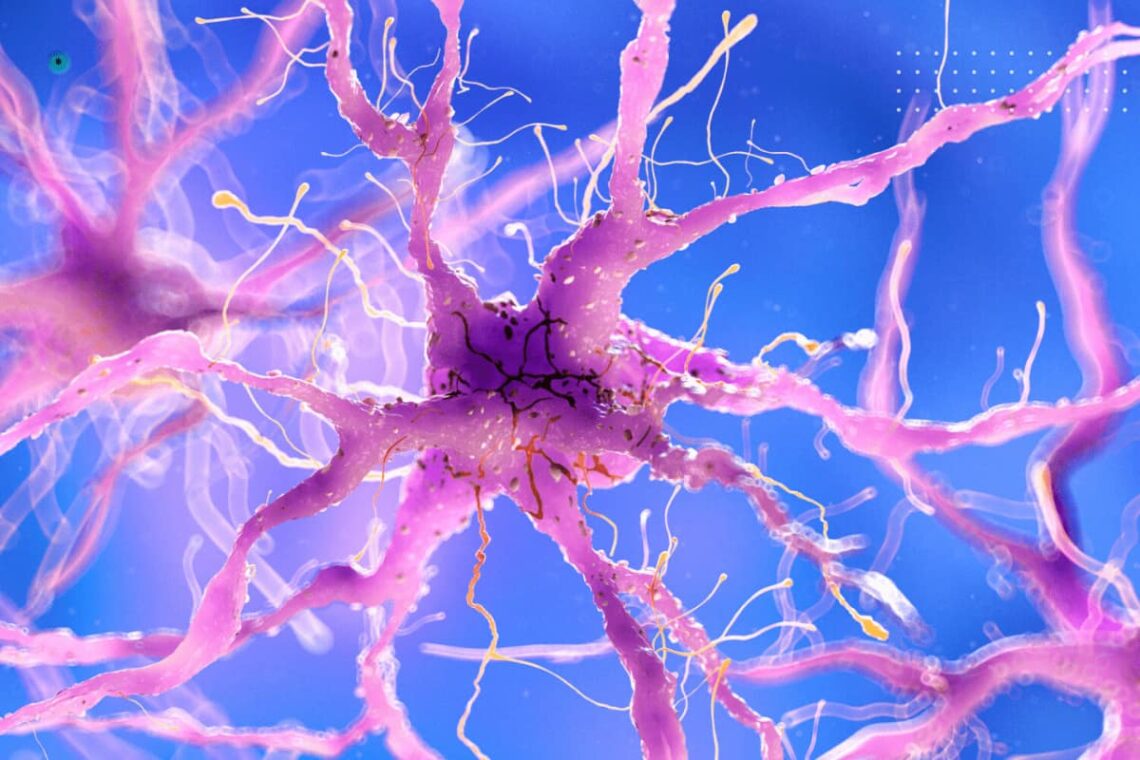 Periventricular heterotopia