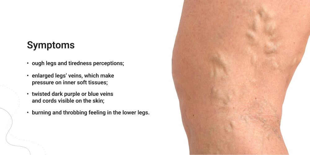 5 Vein Conditions That Cause Brown Spots On Legs - Vein