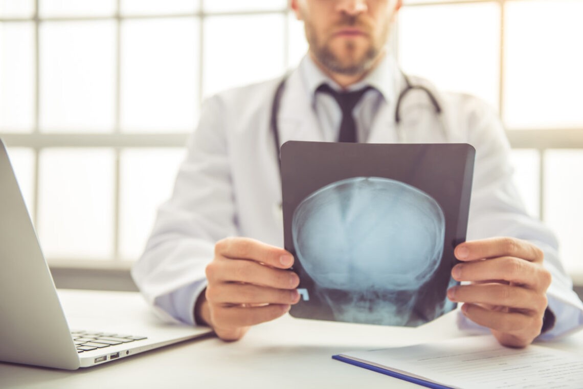 Concussion signs, causes and stmptoms
