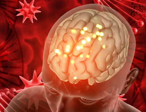 What Is Encephalitis Its Causes and Symptoms