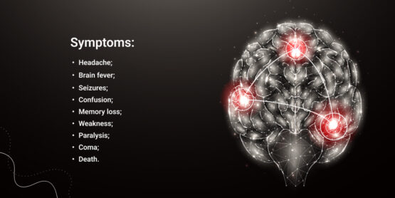 Encephalitis Check: Symptoms, Causes And Treatment.