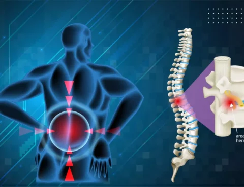 spinal-cord-disorders