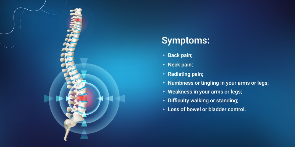 Common spine disorders