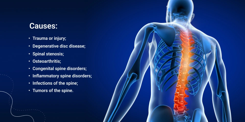 Spine Injuries, Spine Disorders