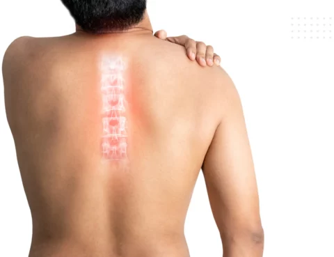 Acute Spinal Cord Injury