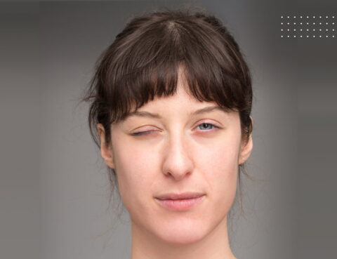 Hemifacial spasm diagnosis and treatment