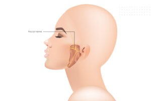 Hemifacial spasm symptoms and causes