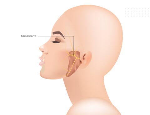 Hemifacial spasm symptoms and causes