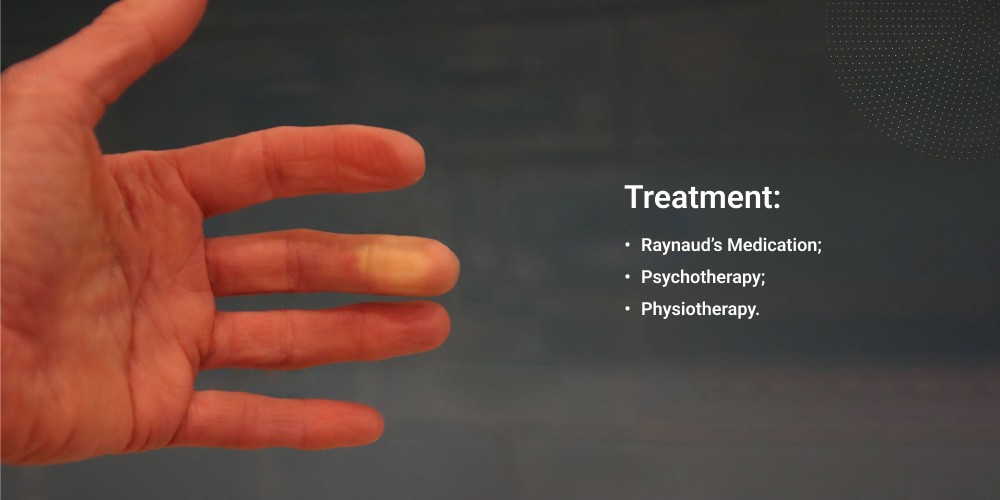 Raynaud Disease Treatment Improving Blood Flow