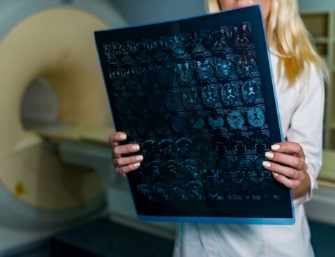 the doctor analyzes the MRI for Brain Damage