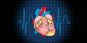 Stroke volume calculation? - Lone Star Neurology