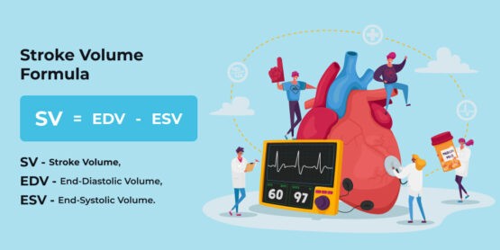 Stroke volume calculation? - Lone Star Neurology