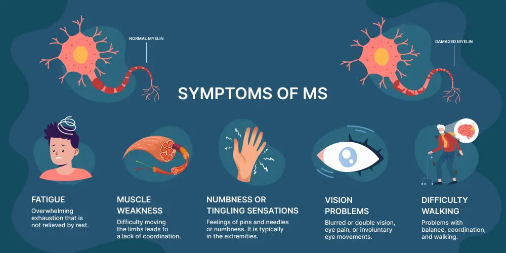 Multiple Sclerosis Recognizing Signs And Symptoms