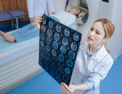 most-common-neurological-disorders