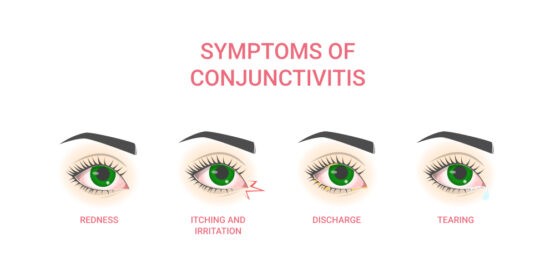 Conjunctivitis: Causes, Symptoms, and Treatment Options