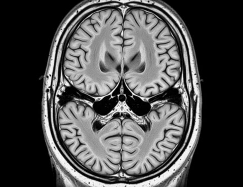 Introduction-to-Functional