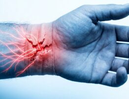 Complex-Regional-Pain-Syndrome